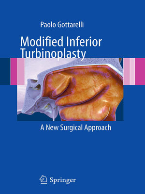 cover image of Modified Inferior Turbinoplasty